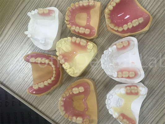 Flexible TCS Valplast Dentadura parcial extraíble fácil de ajustar