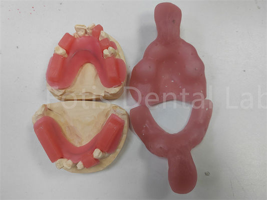 Vibrante Red mordedura de anillos para los dientes superiores o inferiores acabado brillante ligeros