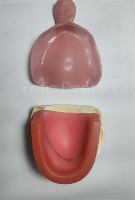 Conjunto de bandejas de blanqueamiento dental higiénico para blanquear los dientes superiores o inferiores
