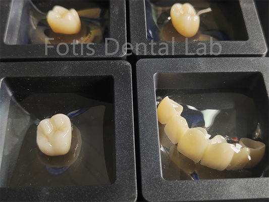 Restauración dental Resistencia a fracturas de zirconia de múltiples capas