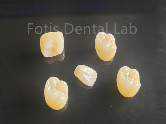 Apelación estética de porcelana completa con capas de zirconia ideal para puentes de coronas