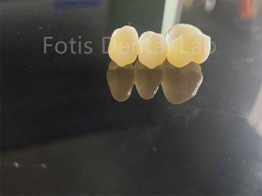 Industria dental Zirconia revestida con porcelana Solución duradera