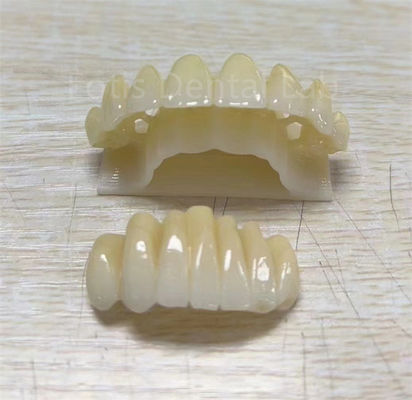 Producto multicapa de zirconia de precisión para mejorar la resistencia a la fractura