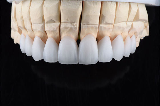 Resistencia a las grietas Zirconia de cerámica de capas múltiples Solución definitiva para la eficiencia industrial