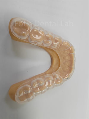 Ergonómico Defensor oclusal duro blando Defensor dental blando Uso a largo plazo