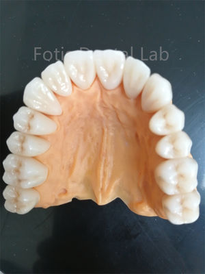 Zirconia avanzada de múltiples capas para una resistencia superior al desgaste y a la corrosión