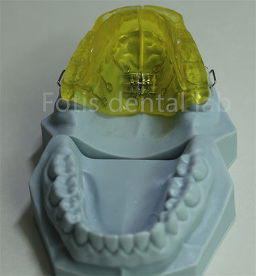 Retenor de ortodoncia personalizable para laboratorio dental de China