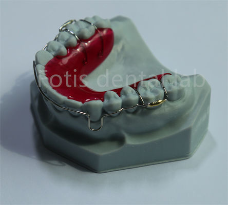 China Laboratorio Dental Retener Expander para la retención dental y la expansión