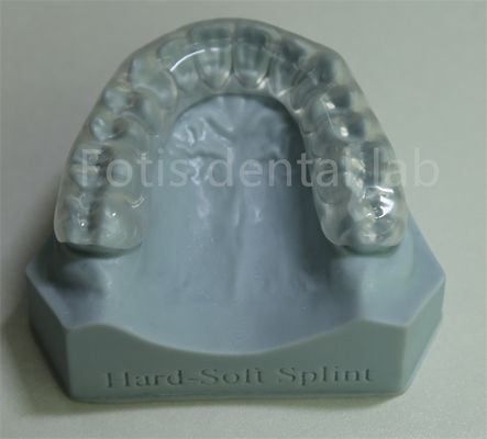 Expansión de retención ortodóntica ajustable y personalizable para retención y expansión de dientes