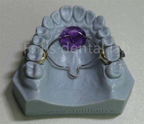 Laboratorio dental de ortodoncia asequible Expansión de retención eficaz para retener y expandir los dientes