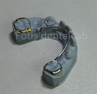 China Dental Laboratorio de retención de ortodoncia para la expansión de los dientes