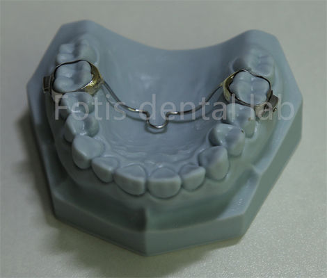 Expansión dental versátil retenedor Solución asequible para la mayoría de los tratamientos de ortodoncia