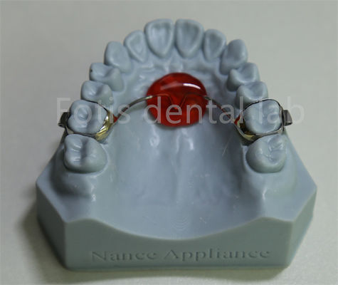 Laboratorio dental Expansor de paladar ortodóntico asequible y compatible con la mayoría de los tratamientos