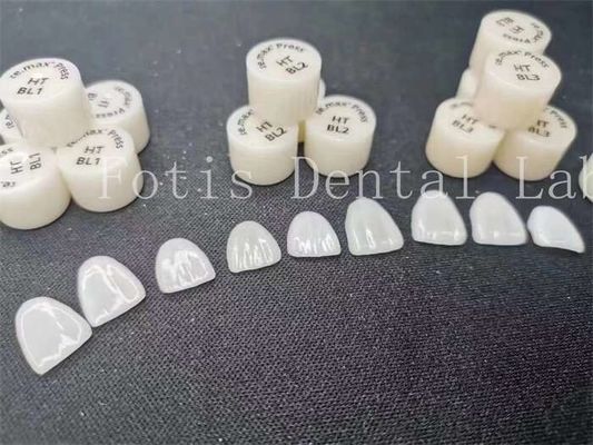 Customization Dental Lab Laminate Veneers with High Stain Resistance and Strength