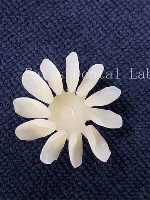 Carillas de porcelana dental resistentes a las manchas de alta resistencia para obtener resultados óptimos
