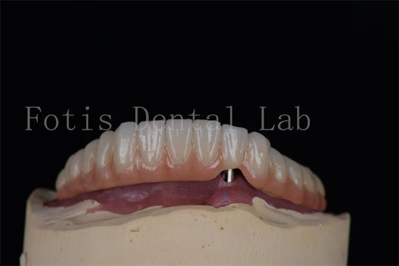 Natural looking Titanium or Zirconia Dental Implants Minimally Invasive Procedure Easy To Clean