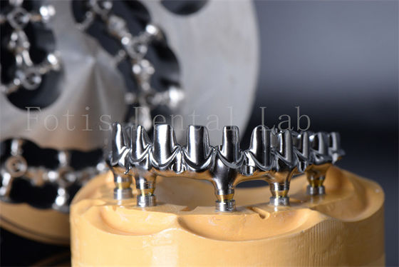 Buen precio Minimalmente invasivo Restaurar masticando todos en 4 Todos en 6 dientes de titanio o zirconio en línea