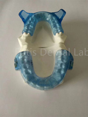 Advanced Orthodontics Appliance For Superior Teeth Alignment Results