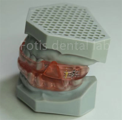 Laboratorio Dental Hyrax Expander de precio asequible Retener ortodóntico fácil de limpiar y mantener